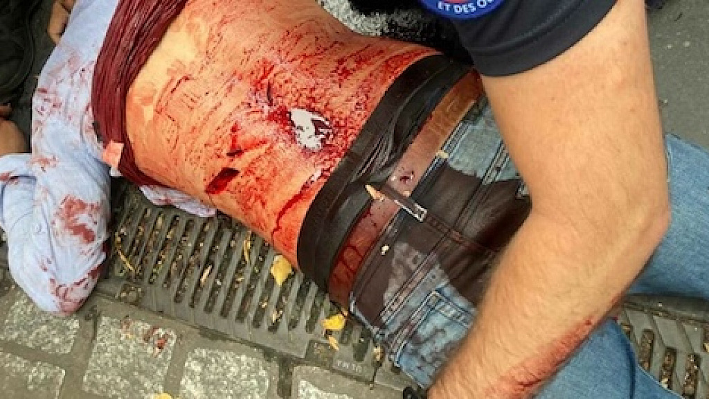 Paris Erupts in Violence Brutal Knife Fight Among Afghan Migrants Leaves Four Injured Six Arrested Video